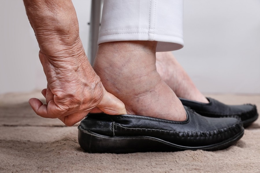 La nonna hai i piedi gonfi